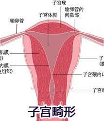 ӹ